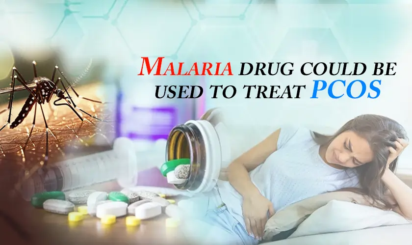  Malaria drug could be used to treat PCOS 