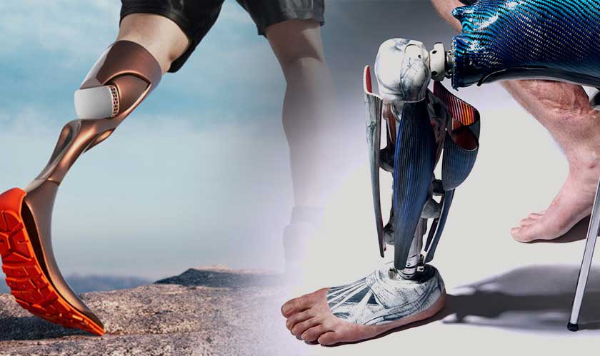 Самый дорогой протез. Биомеханические протезы. Современные протезы ног. Самые современные протезы ног.