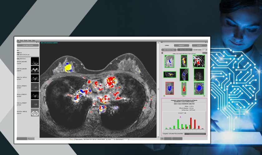 Scientists develop a new AI