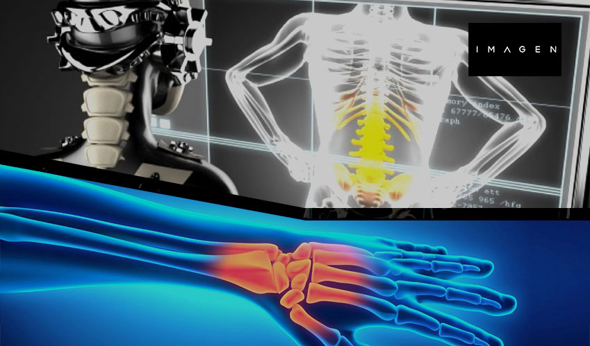 AI tools that detect wrist fractures get FDA approval