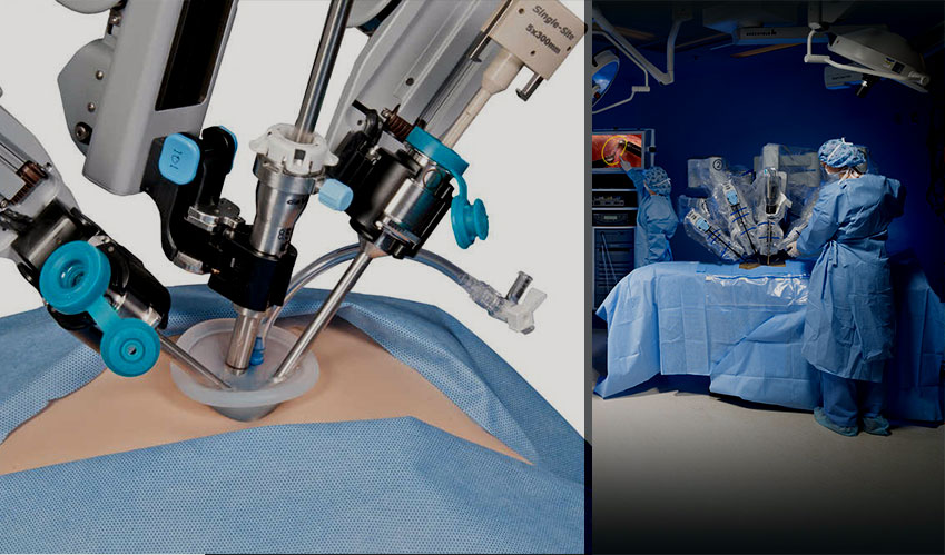 Da Vinci, a surgical robot