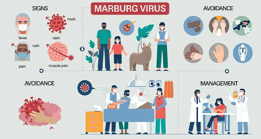 Recognizing the Marburg Virus: Signs, Avoidance, and Management