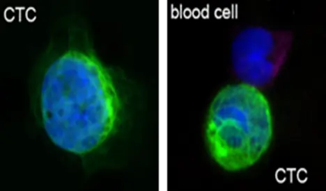 Images of circulating tumor cells