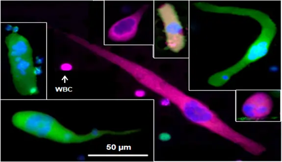 Images of cancer-associated macrophage-like cells